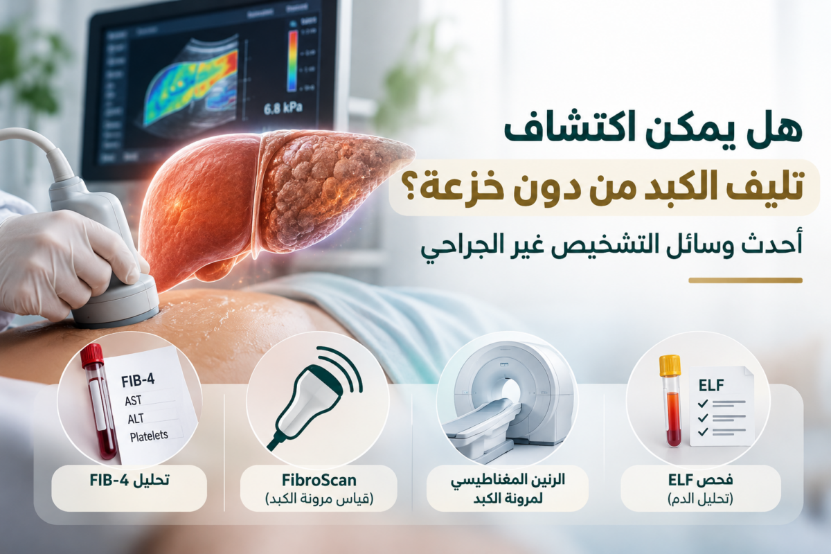 تشخيص-تليف-الكبد-دون-خزعة-1200x800.png